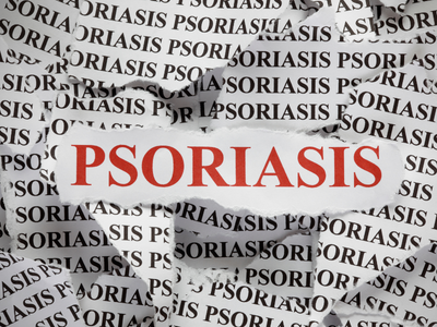 29 Οκτωβρίου - Παγκόσμια Ημέρα Ψωρίασης