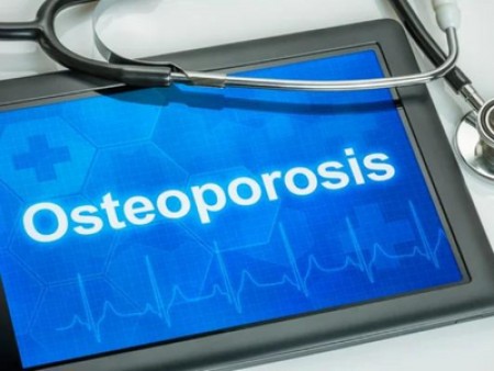 Οστεοπόρωση